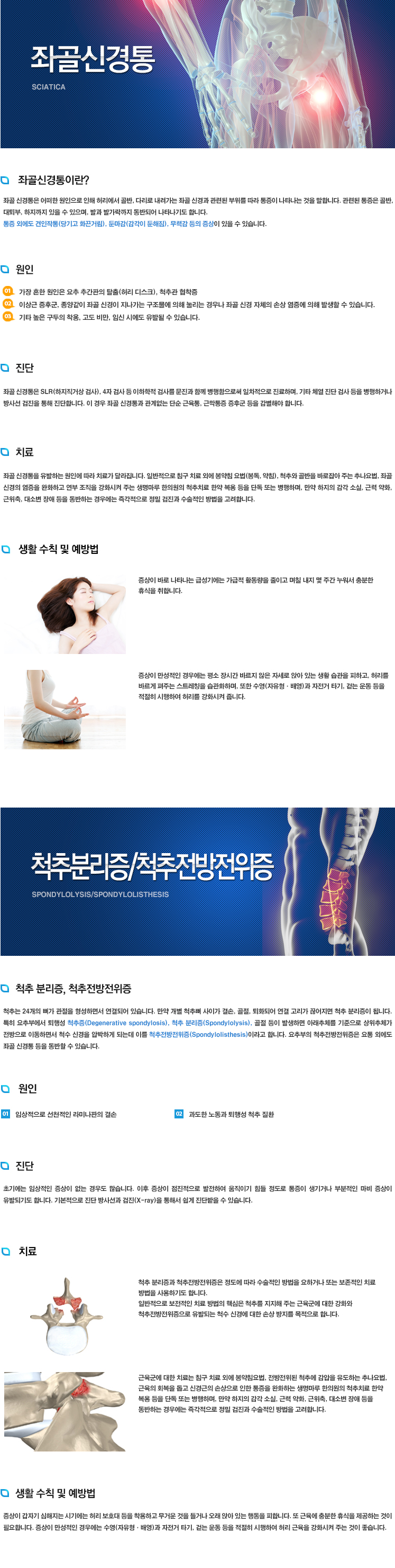 기타(좌골신경통,척추분리증,척추전방전